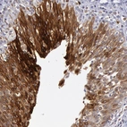 Immunohistochemical staining of human urinary bladder shows strong cytoplasmic positivity in urothelial cells.