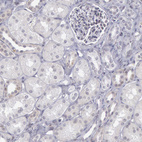 Anti-PTGS2 Antibody