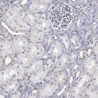 Immunohistochemical staining of human kidney shows no positivity in cells in tubules and cells in glomeruli as expected.