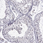 Immunohistochemical staining of human testis shows no positivity in cells in seminiferous ducts as expected.