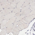 Immunohistochemical staining of human skeletal muscle shows no positivity in myocytes as expected.