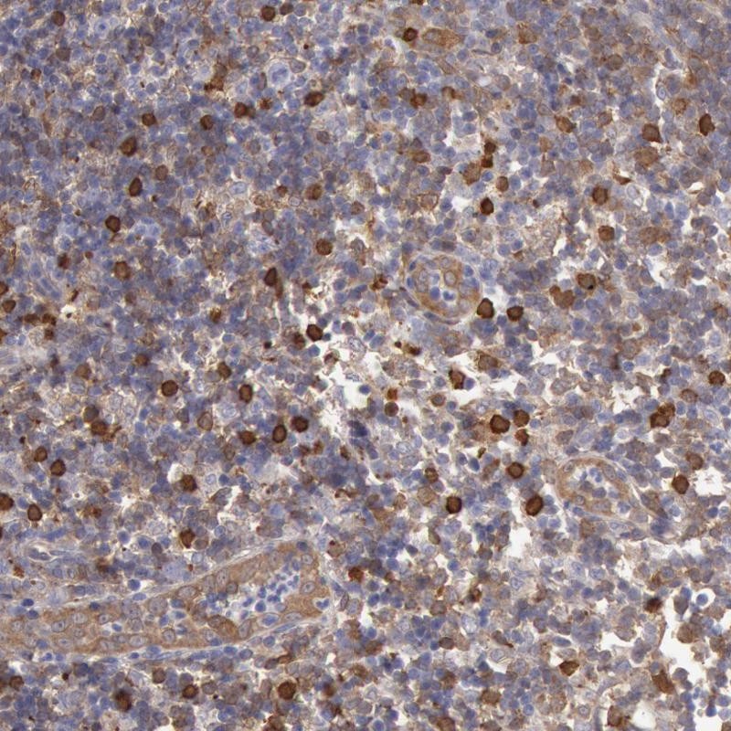 Anti-CCDC50 Antibody