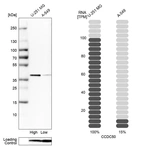 Western blot analysis in human cell lines U-251MG and A-549 using Anti-CCDC50 antibody. Corresponding CCDC50 RNA-seq data are presented for the same cell lines. Loading control: Anti-PFN1.