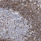 Immunohistochemical staining of human lymph node shows strong nuclear positivity in non-germinal center cells.