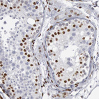 Immunohistochemical staining of human testis shows strong nuclear positivity in cells in seminiferous ducts.