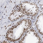 Immunohistochemical staining of human prostate shows moderate to strong nuclear positivity in glandular cells.