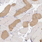 Immunohistochemical staining of human skeletal muscle shows moderate cytoplasmic positivity in a subset of myocytes.