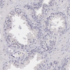 Immunohistochemical staining of human prostate shows no positivity in smooth muscle cells as expected.