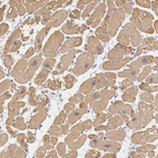 Anti-MYH6 Antibody