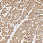 Immunohistochemical staining of human heart muscle shows moderate cytoplasmic positivity in cardiomyocytes.