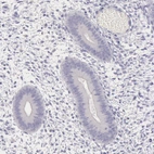 Immunohistochemical staining of human endometrium shows no positivity in glandular cells as expected.