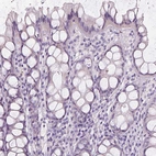 Immunohistochemical staining of human colon shows no positivity in glandular cells as expected.
