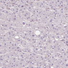 Immunohistochemical staining of human liver shows no positivity in hepatocytes as expected.