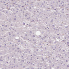 Anti-APOA4 Antibody