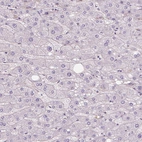Immunohistochemical staining of human liver shows no positivity in hepatocytes as expected.