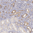 Immunohistochemical staining of human kidney shows moderate membranous positivity in cells in tubules.