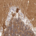 Immunohistochemical staining of human cerebellum shows strong cytoplasmic positivity in Purkinje cells.