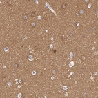 Immunohistochemical staining of human cerebral cortex shows strong membranous positivity in neuropil.