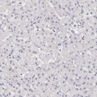 Immunohistochemical staining of human liver shows no positivity in hepatocytes as expected.