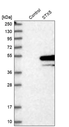 Western blot analysis in control (vector only transfected HEK293T lysate) and STX5 over-expression lysate (Co-expressed with a C-terminal myc-DDK tag (~3.1 kDa) in mammalian HEK293T cells, LY418853).