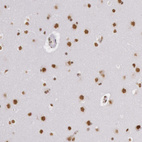 Anti-HNRNPH2 Antibody