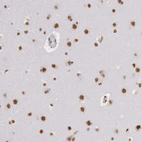 Anti-HNRNPH2 Antibody