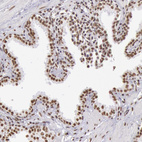 Anti-HNRNPH2 Antibody