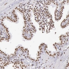 Immunohistochemical staining of human prostate shows moderate nuclear positivity in glandular cells.