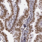 Immunohistochemical staining of human fallopian tube shows moderate nuclear positivity in glandular cells.