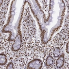 Immunohistochemical staining of human gastrointestinal shows moderate nuclear positivity in glandular cells.
