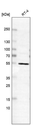 Western blot analysis in human cell line RT-4.