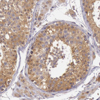 Anti-CDK16 Antibody