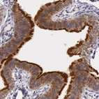 Immunohistochemical staining of human fallopian tube shows moderate to strong cytoplasmic positivity in glandular cells.