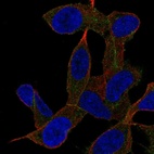 Anti-GAB2 Antibody