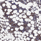 Anti-FES Antibody