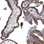 Immunohistochemical staining of human Placenta shows moderate cytoplasmic positivity in trophoblastic cells.