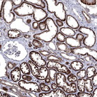 Anti-FES Antibody