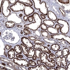 Immunohistochemical staining of human Kidney shows strong cytoplasmic positivity in cells in tubules.