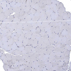 Immunohistochemical staining of human Skeletal muscle shows no cytoplasmic positivity in myocytes as expected.