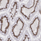 Anti-PNN Antibody
