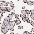 Anti-PNN Antibody