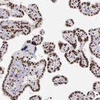 Immunohistochemical staining of human placenta shows strong nuclear positivity in trophoblastic cells.