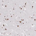 Anti-PNN Antibody