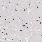Immunohistochemical staining of human cerebral cortex shows strong nuclear positivity in neuronal cells.