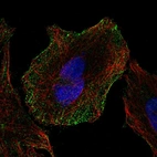 Immunofluorescent staining of human cell line SiHa shows localization to plasma membrane.