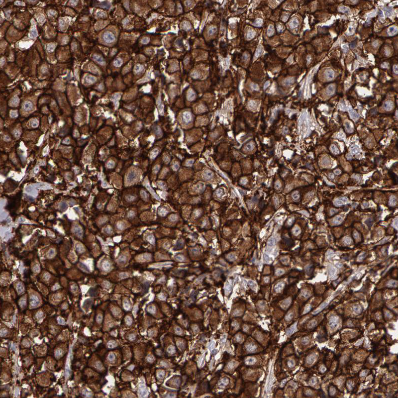 Anti-ERBB2 Antibody