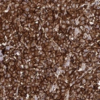 Anti-ERBB2 Antibody