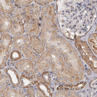 Anti-ERBB2 Antibody