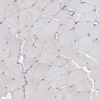 Immunohistochemical staining of human skeletal muscle shows no positivity in myocytes as expected.