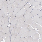 Immunohistochemical staining of human skeletal muscle shows no positivity in myocytes as expected.